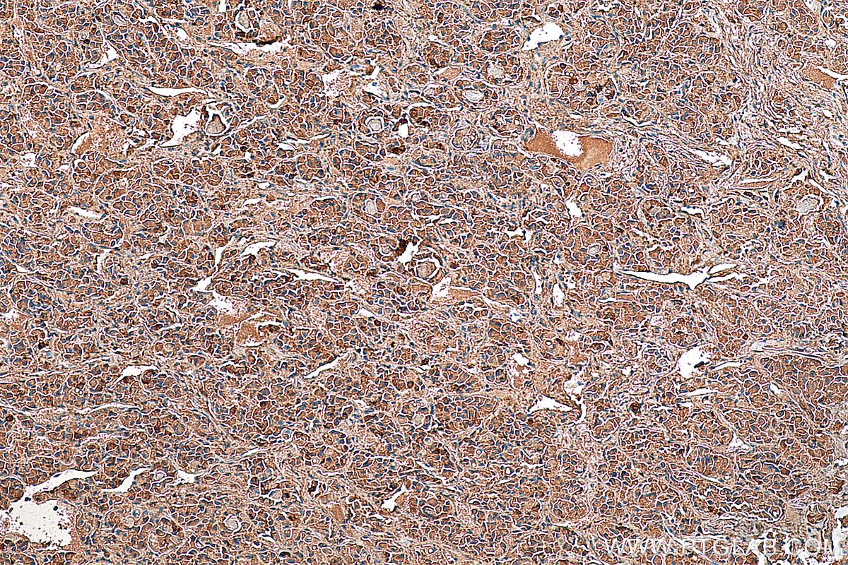 Immunohistochemistry (IHC) staining of human pituitary tissue using SSTR3 Polyclonal antibody (20696-1-AP)