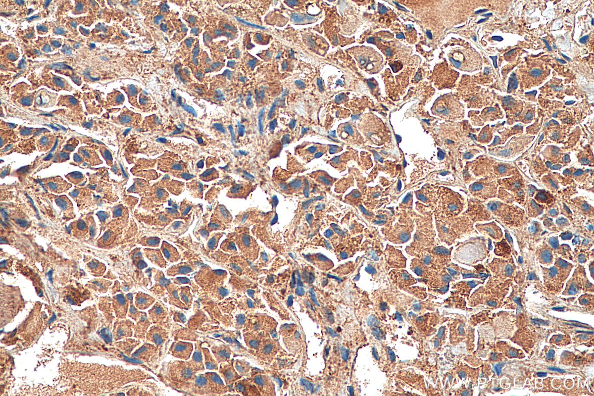 Immunohistochemistry (IHC) staining of human pituitary tissue using SSTR3 Polyclonal antibody (20696-1-AP)