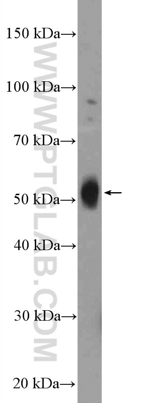 Western Blot (WB) analysis of fetal human brain tissue using SSTR3 Polyclonal antibody (20696-1-AP)