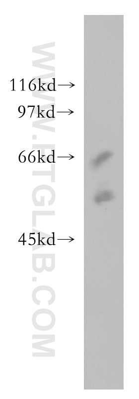 Western Blot (WB) analysis of human placenta tissue using SSTR5 Polyclonal antibody (51029-2-AP)