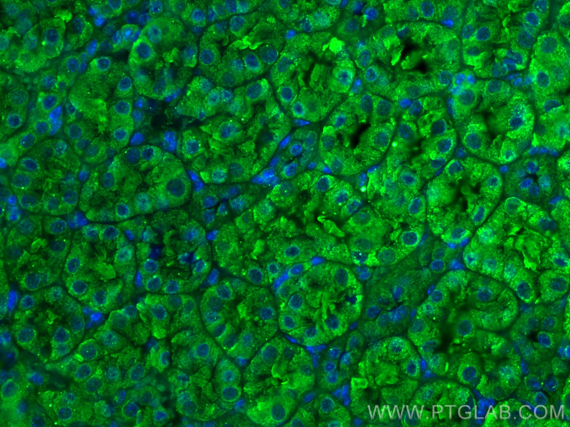Immunofluorescence (IF) / fluorescent staining of mouse kidney tissue using SSTR5 Monoclonal antibody (66772-1-Ig)
