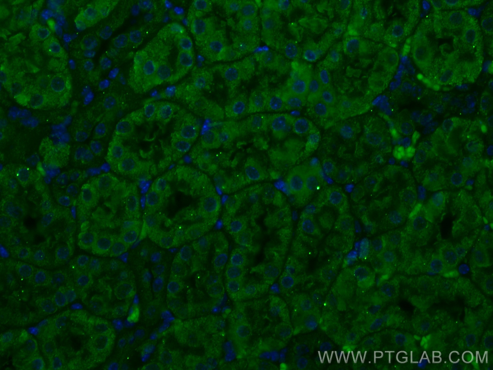 Immunofluorescence (IF) / fluorescent staining of mouse kidney tissue using CoraLite® Plus 488-conjugated SSTR5 Monoclonal ant (CL488-66772)