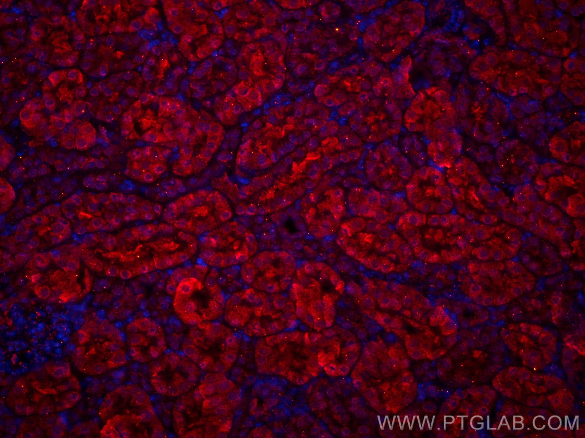 Immunofluorescence (IF) / fluorescent staining of mouse kidney tissue using CoraLite®594-conjugated SSTR5 Monoclonal antibody (CL594-66772)