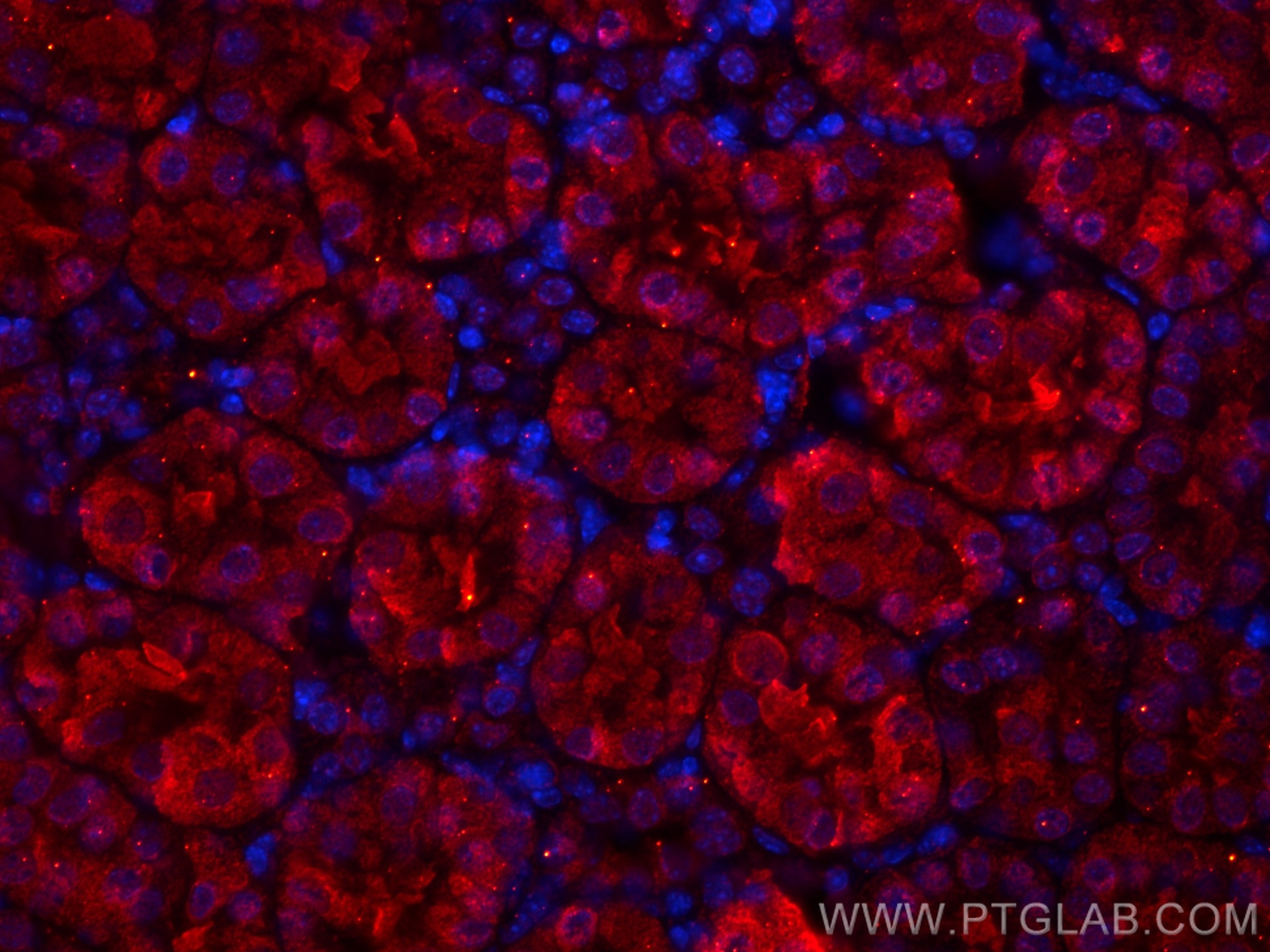 Immunofluorescence (IF) / fluorescent staining of mouse kidney tissue using CoraLite®594-conjugated SSTR5 Monoclonal antibody (CL594-66772)