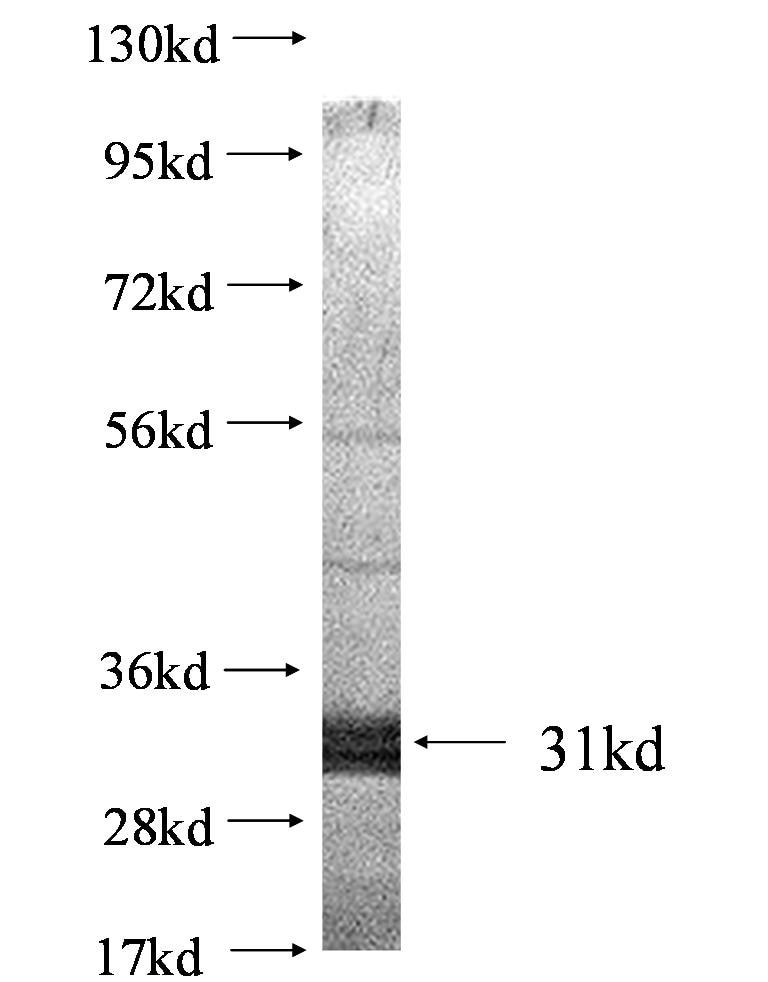 SSTR5 fusion protein Ag0519 SDS-PAGE