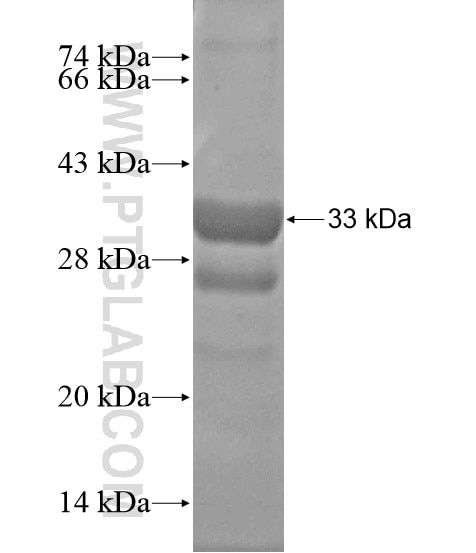 SSTR5 fusion protein Ag18615 SDS-PAGE