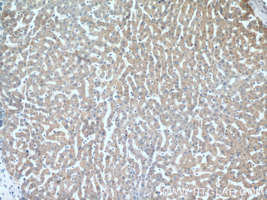 Immunohistochemistry (IHC) staining of human liver tissue using SSU72 Polyclonal antibody (15434-1-AP)