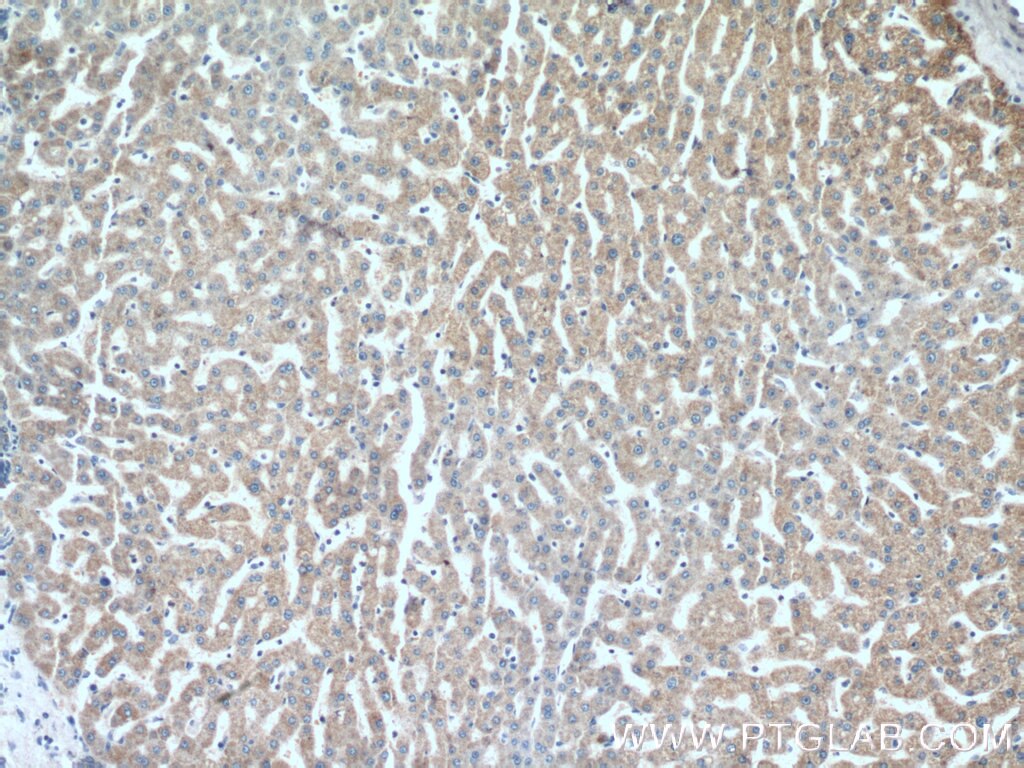 IHC staining of human liver using 15434-1-AP