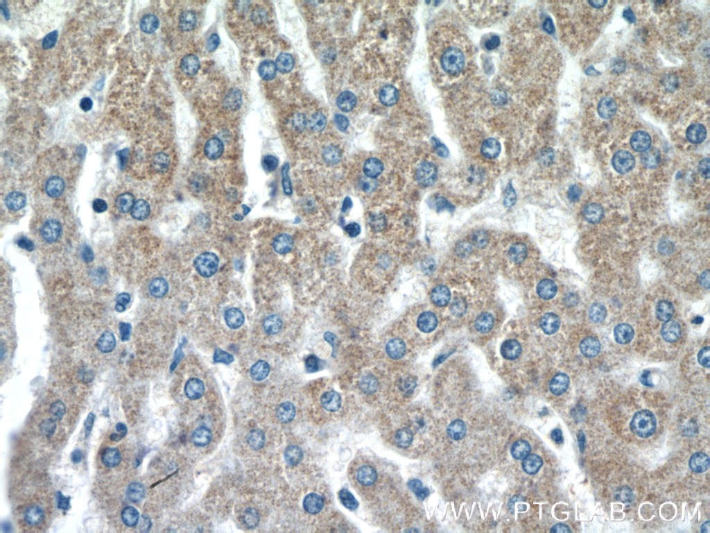 Immunohistochemistry (IHC) staining of human liver tissue using SSU72 Polyclonal antibody (15434-1-AP)