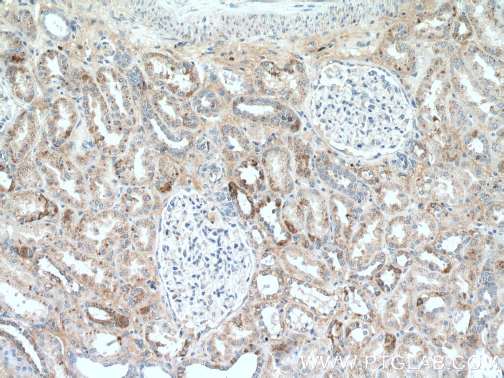 Immunohistochemistry (IHC) staining of human kidney tissue using SSU72 Polyclonal antibody (15434-1-AP)