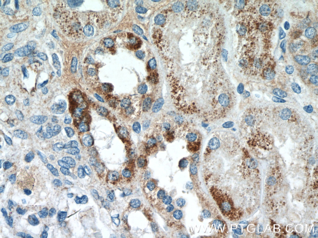 Immunohistochemistry (IHC) staining of human kidney tissue using SSU72 Polyclonal antibody (15434-1-AP)