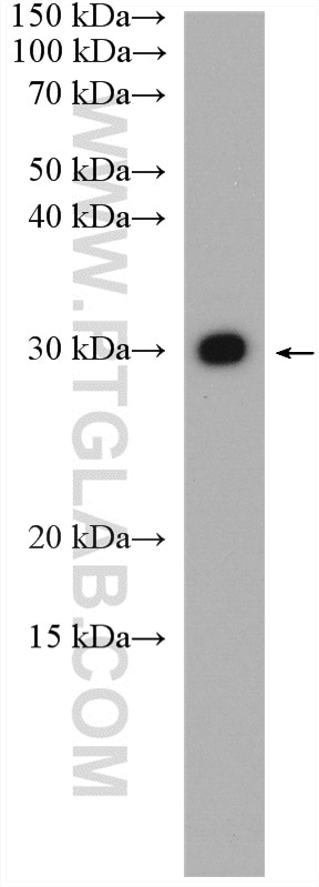 Western Blot (WB) analysis of HeLa cells using SSU72 Polyclonal antibody (15434-1-AP)