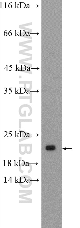 Western Blot (WB) analysis of HeLa cells using SSX1 Polyclonal antibody (11670-1-AP)