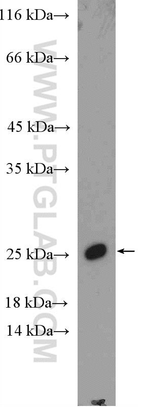 Western Blot (WB) analysis of PC-3 cells using SSX1 Polyclonal antibody (11670-1-AP)