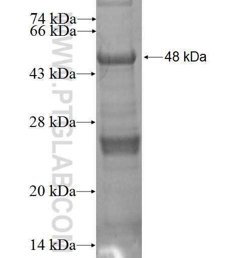 SSX1 fusion protein Ag2254 SDS-PAGE