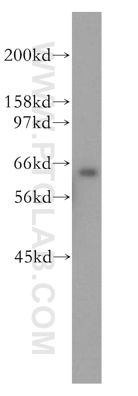 Western Blot (WB) analysis of HEK-293 cells using SSX2IP Polyclonal antibody (13694-1-AP)