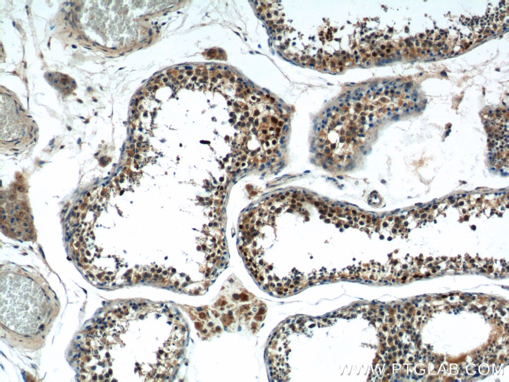 Immunohistochemistry (IHC) staining of human testis tissue using SSX4 Polyclonal antibody (15876-1-AP)