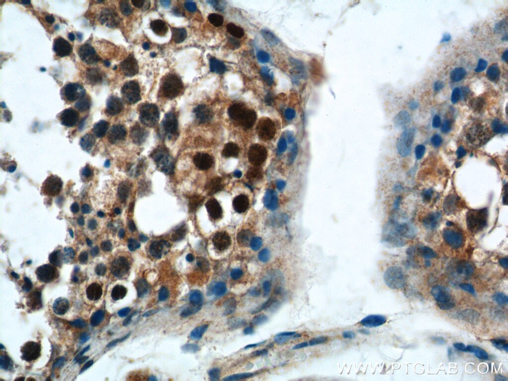 Immunohistochemistry (IHC) staining of human testis tissue using SSX4 Polyclonal antibody (15876-1-AP)