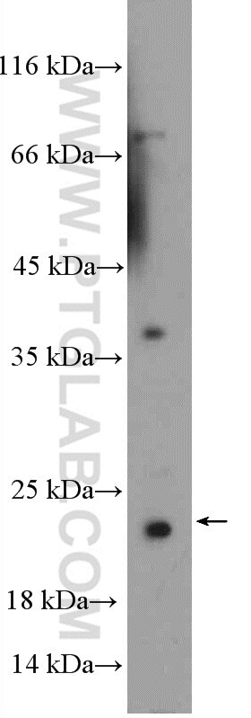 Western Blot (WB) analysis of A549 cells using SSX4 Polyclonal antibody (15876-1-AP)