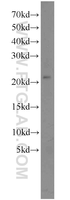 Western Blot (WB) analysis of K-562 cells using SSX4 Polyclonal antibody (15876-1-AP)