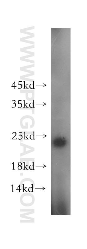 Western Blot (WB) analysis of MCF-7 cells using SSX4 Polyclonal antibody (15876-1-AP)