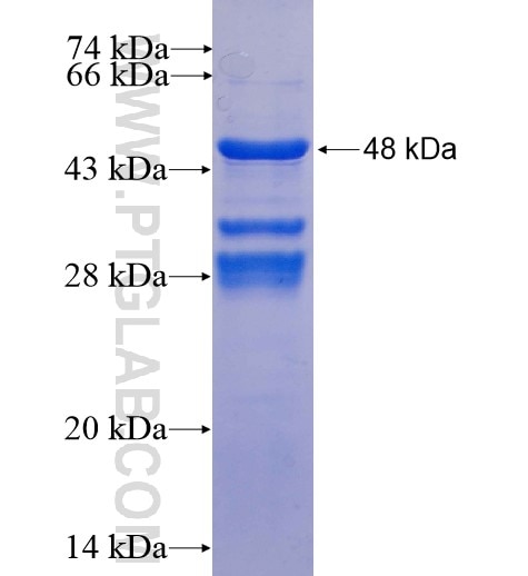 SSX4 fusion protein Ag8637 SDS-PAGE