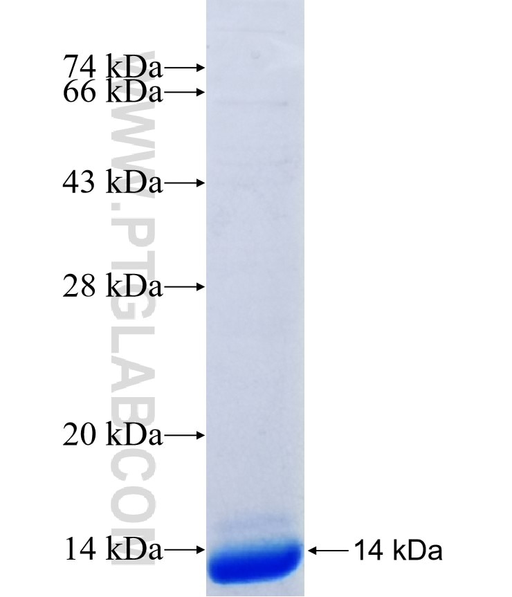 SSX4B fusion protein Ag37027 SDS-PAGE