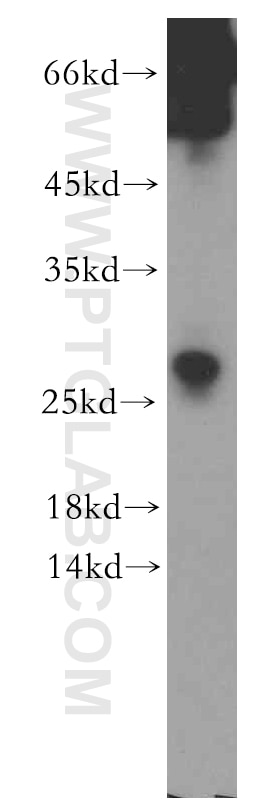 Western Blot (WB) analysis of human testis tissue using SSX5 Polyclonal antibody (12401-1-AP)