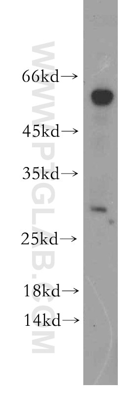 Western Blot (WB) analysis of A431 cells using SSX5 Polyclonal antibody (12401-1-AP)