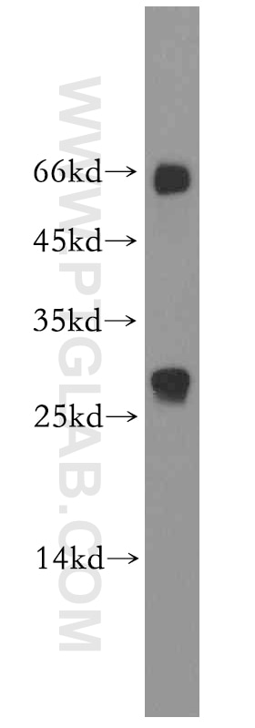 Western Blot (WB) analysis of human testis tissue using SSX5 Polyclonal antibody (12401-1-AP)