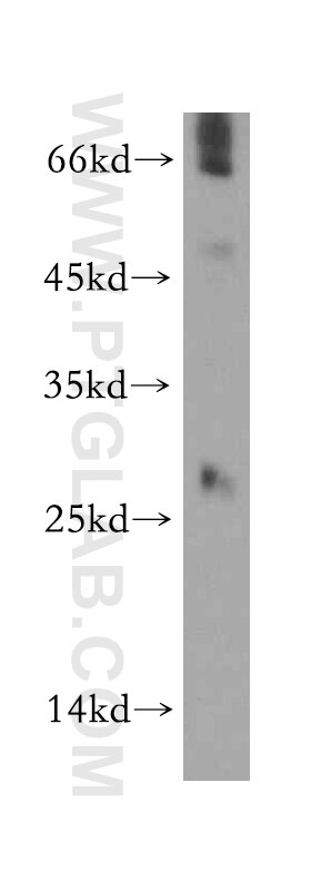 Western Blot (WB) analysis of mouse testis tissue using SSX5 Polyclonal antibody (12401-1-AP)