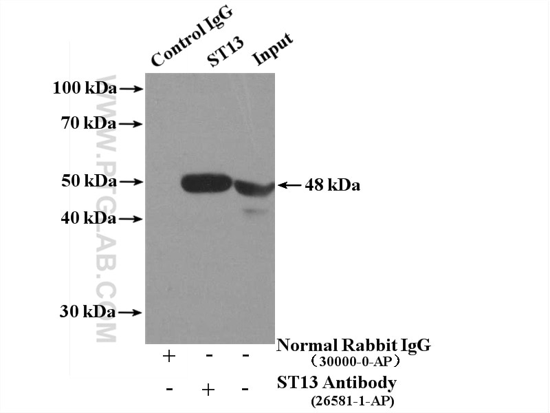 Immunoprecipitation (IP) experiment of HEK-293 cells using ST13 Polyclonal antibody (26581-1-AP)