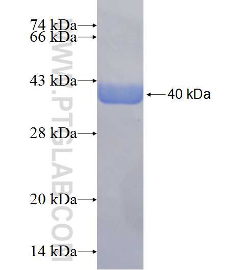 ST13 fusion protein Ag24779 SDS-PAGE