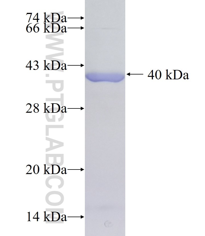 ST13 fusion protein Ag36889 SDS-PAGE ST13 fusion protein Ag36889 SDS-PAGE