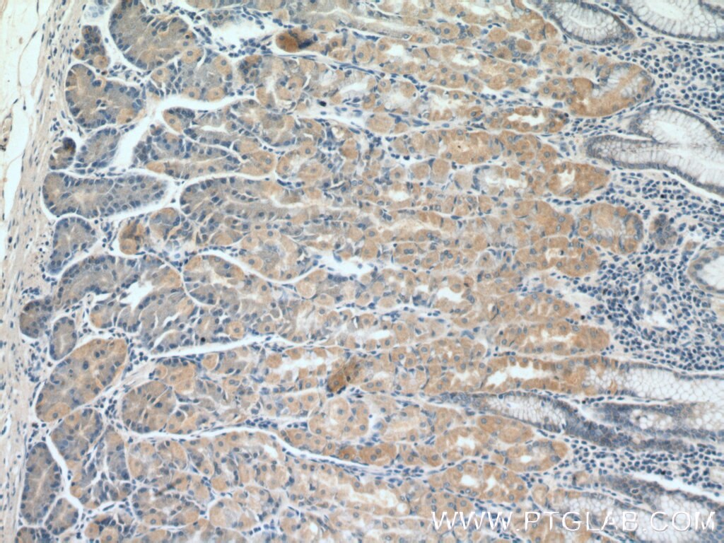 Immunohistochemistry (IHC) staining of human stomach tissue using ST14 Polyclonal antibody (27176-1-AP)