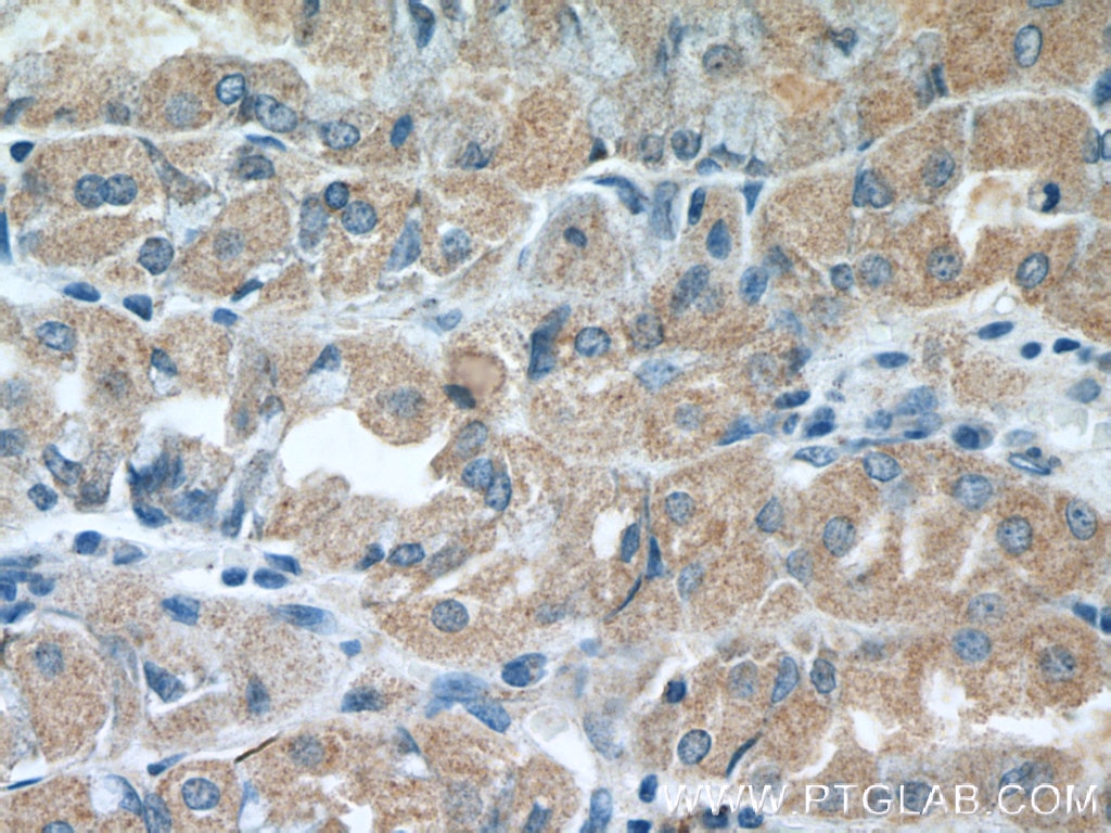 Immunohistochemistry (IHC) staining of human stomach tissue using ST14 Polyclonal antibody (27176-1-AP)