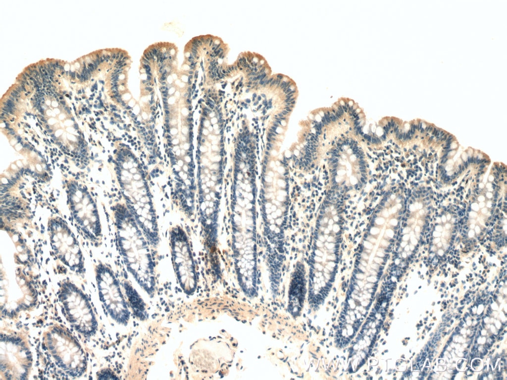 Immunohistochemistry (IHC) staining of human colon tissue using ST14 Polyclonal antibody (27176-1-AP)