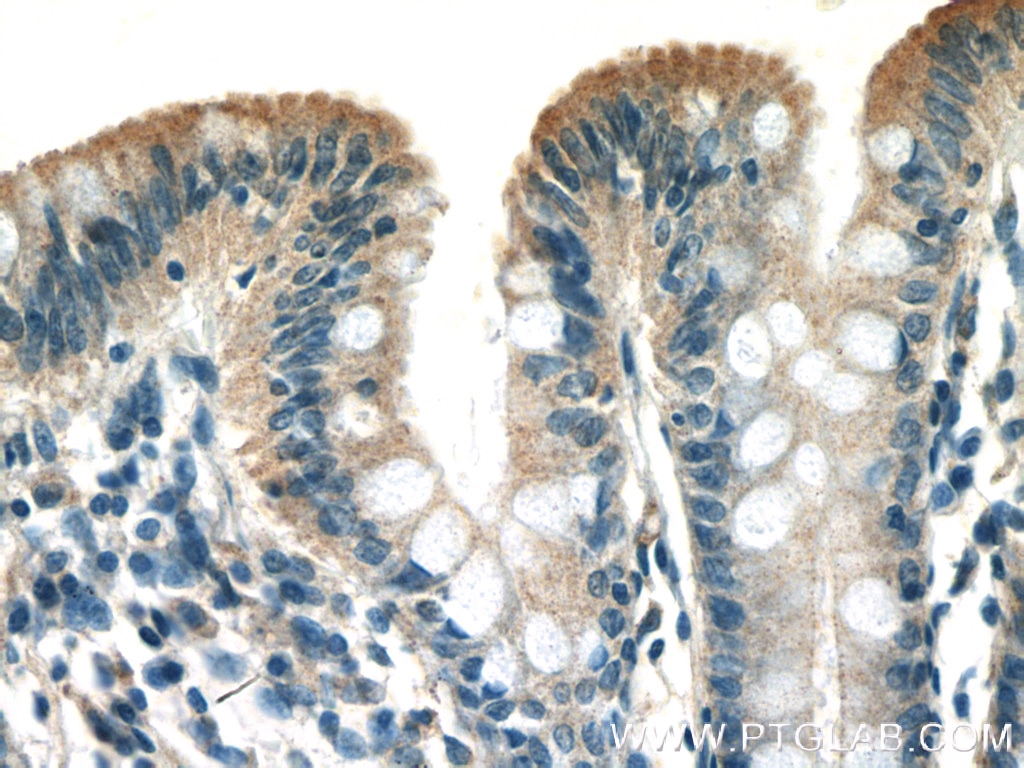 Immunohistochemistry (IHC) staining of human colon tissue using ST14 Polyclonal antibody (27176-1-AP)