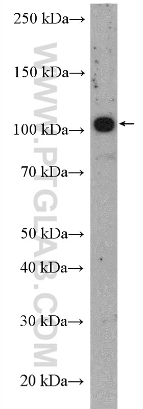 Western Blot (WB) analysis of MCF-7 cells using ST14 Polyclonal antibody (27176-1-AP)