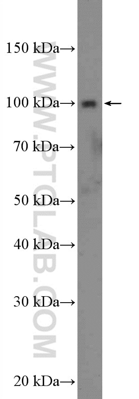 Western Blot (WB) analysis of MCF-7 cells using ST14 Polyclonal antibody (27176-1-AP)