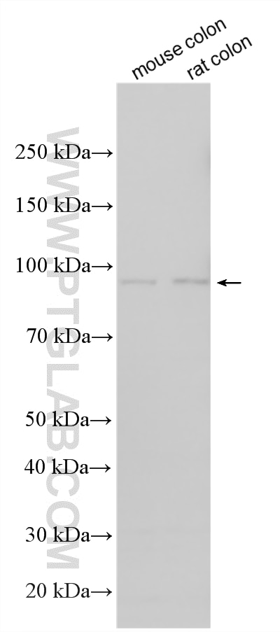 Western Blot (WB) analysis of various lysates using ST14 Polyclonal antibody (27176-1-AP)