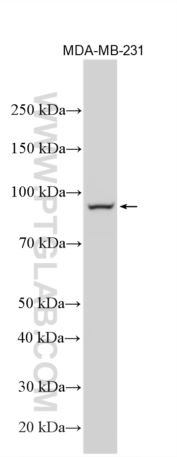 Western Blot (WB) analysis of various lysates using ST14 Polyclonal antibody (27176-1-AP)