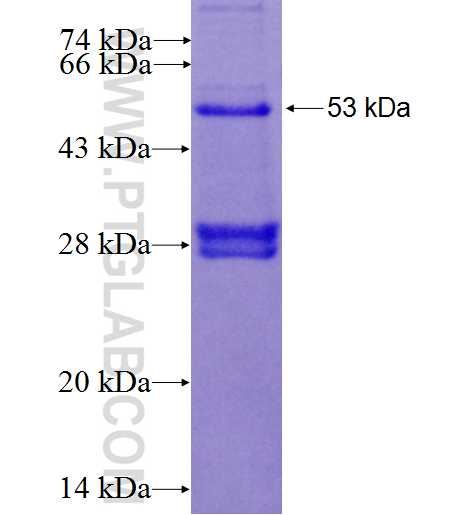 ST14 fusion protein Ag26007 SDS-PAGE