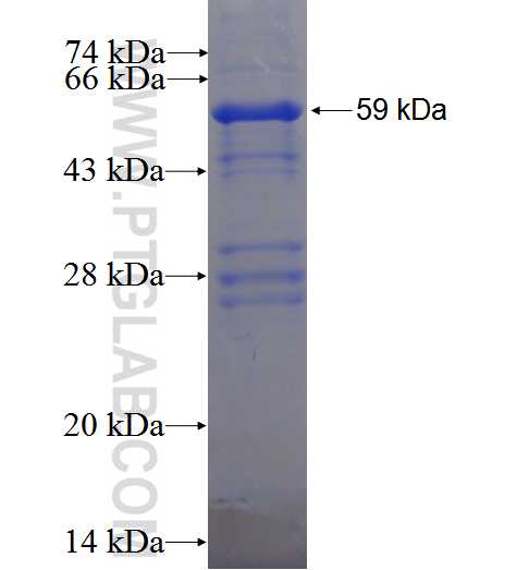 ST14 fusion protein Ag5928 SDS-PAGE
