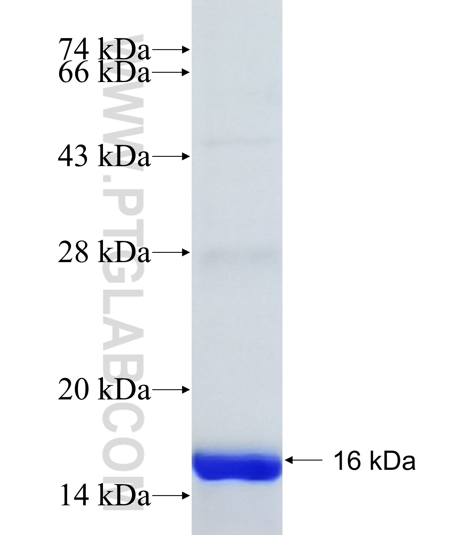 ST18 fusion protein Ag40938 SDS-PAGE