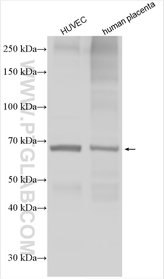 Western Blot (WB) analysis of various lysates using ST2 Polyclonal antibody (30194-1-AP)