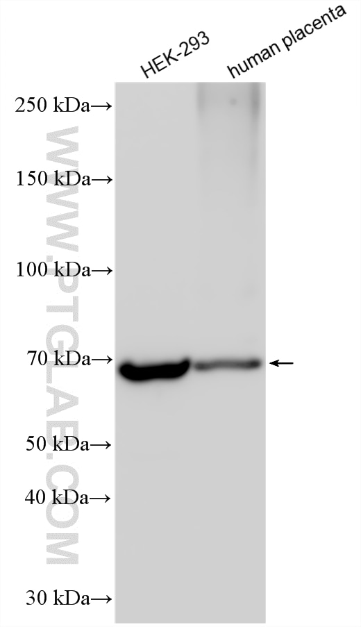 Western Blot (WB) analysis of various lysates using IL-1RL1/ST2 Polyclonal antibody (30194-1-AP)