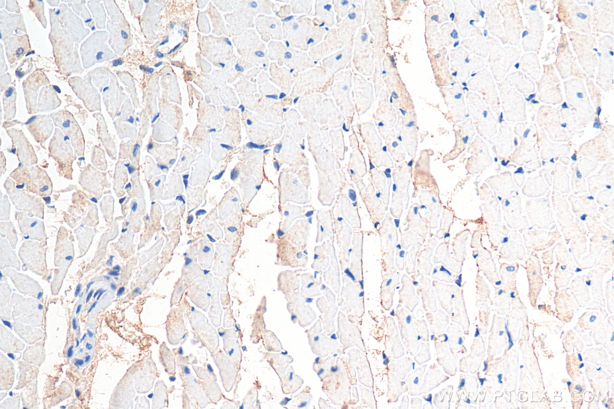 Immunohistochemistry (IHC) staining of rat heart tissue using ST3GAL2 Polyclonal antibody (13620-1-AP)