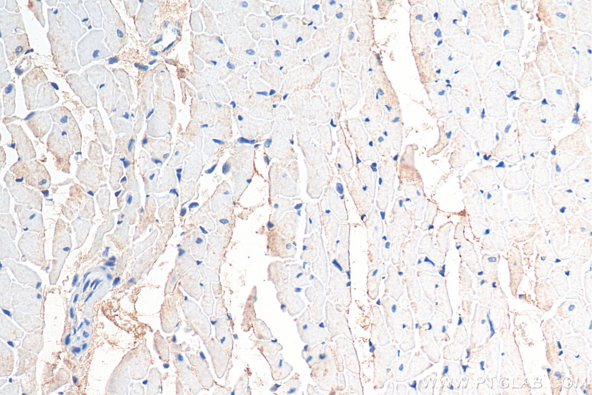 Immunohistochemistry (IHC) staining of rat heart tissue using ST3GAL2 Polyclonal antibody (13620-1-AP)