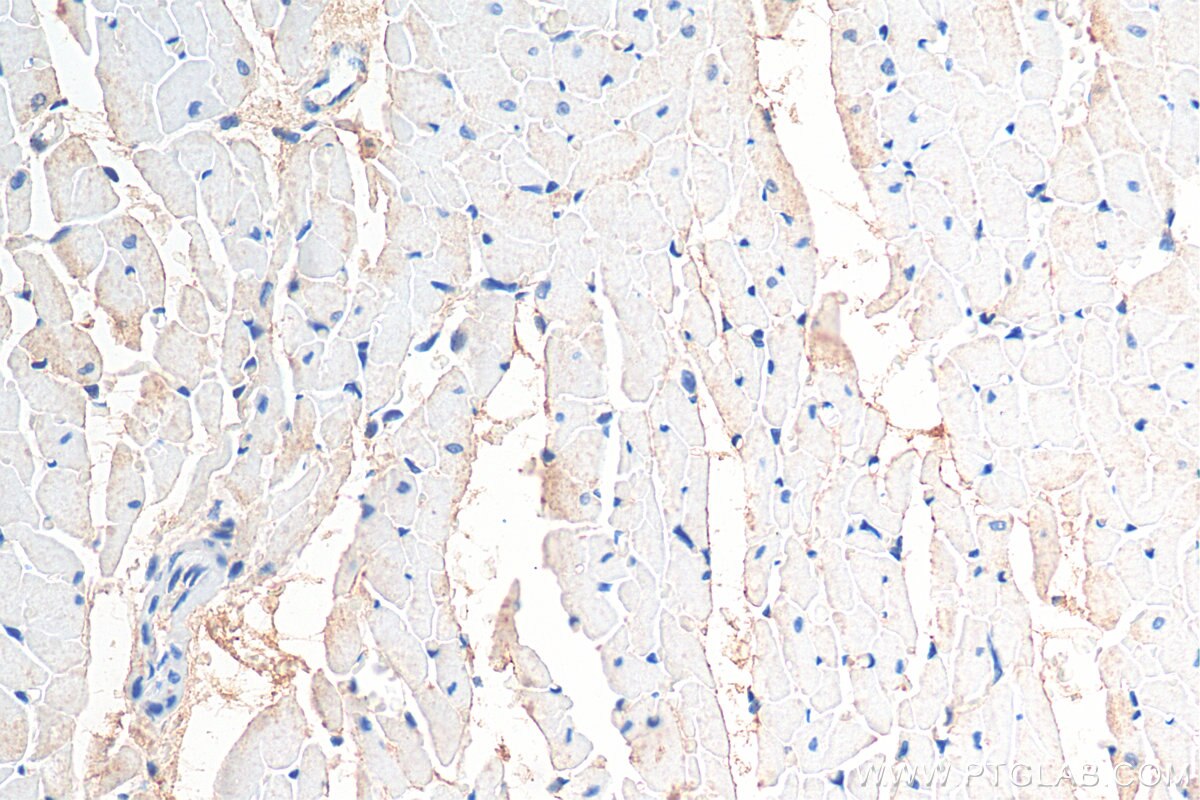 IHC staining of rat heart using 13620-1-AP